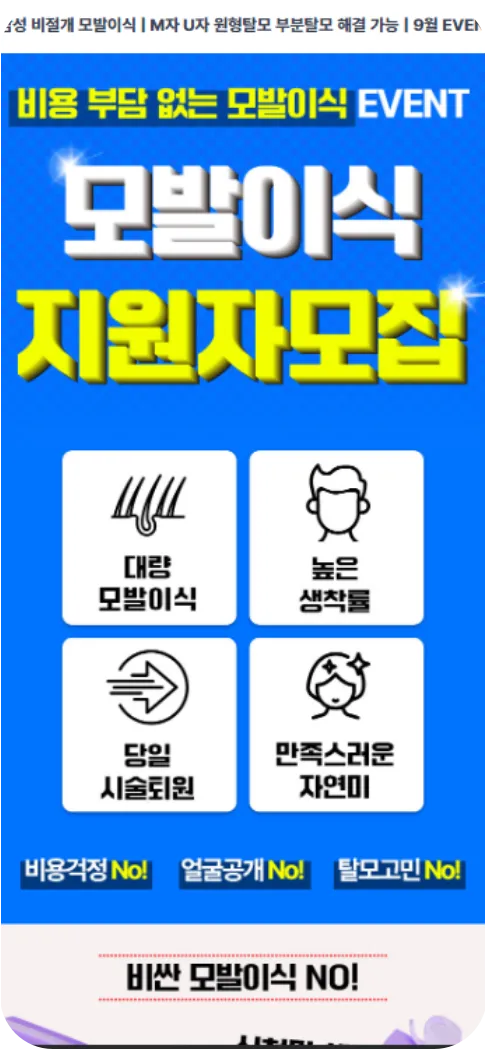 모발이식 사이트